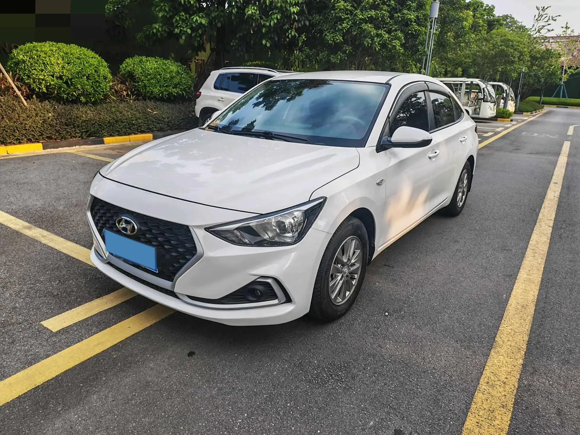 2017 HYUNDAI CELESTA view 1