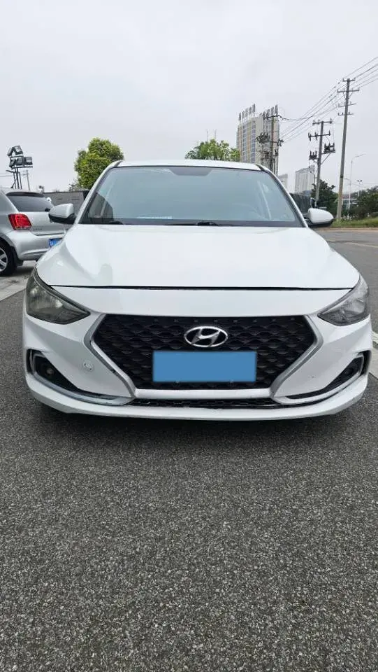 2017 HYUNDAI CELESTA thumbnail 2
