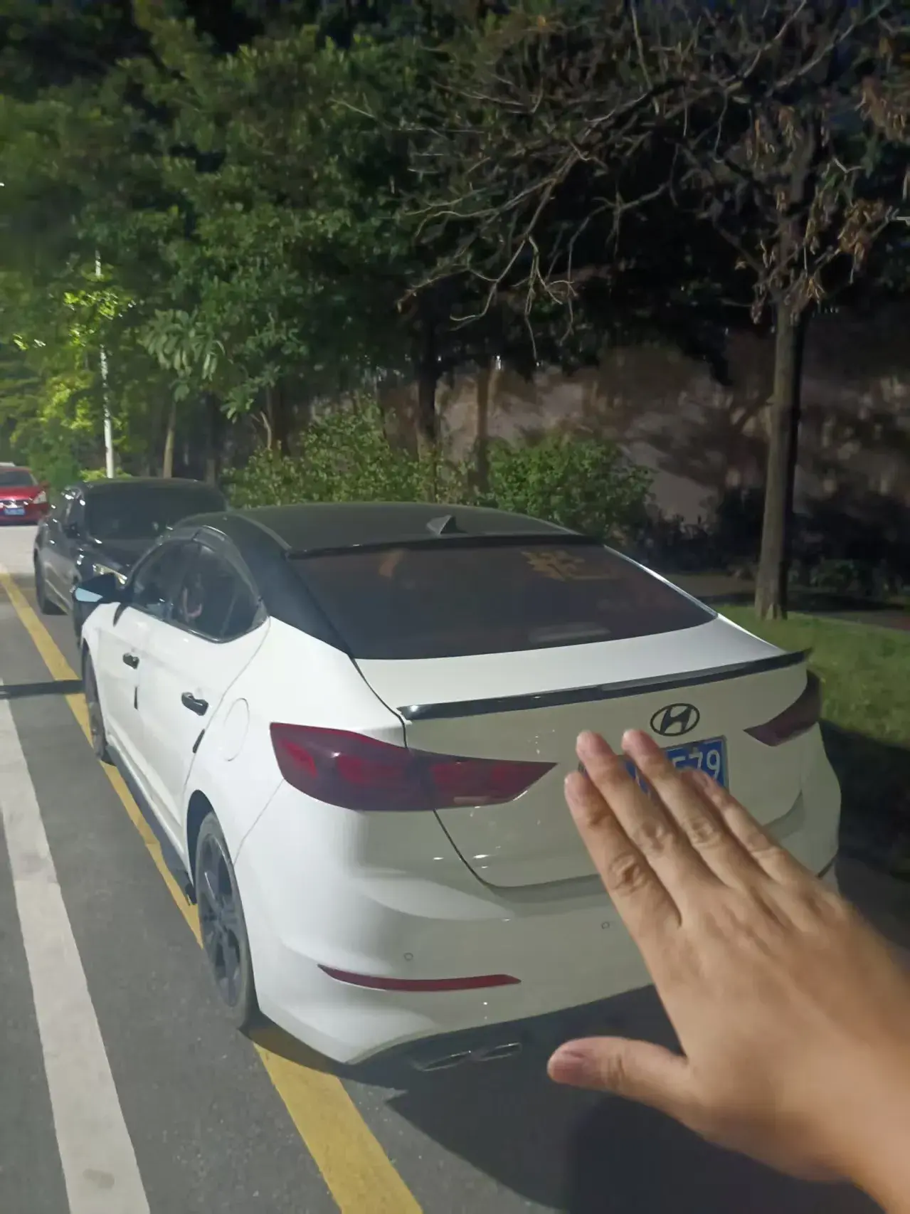 2018 HYUNDAI ELANTRA thumbnail 2