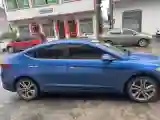 2016 Hyundai Elantra 1.6L 130HP L4 6AT