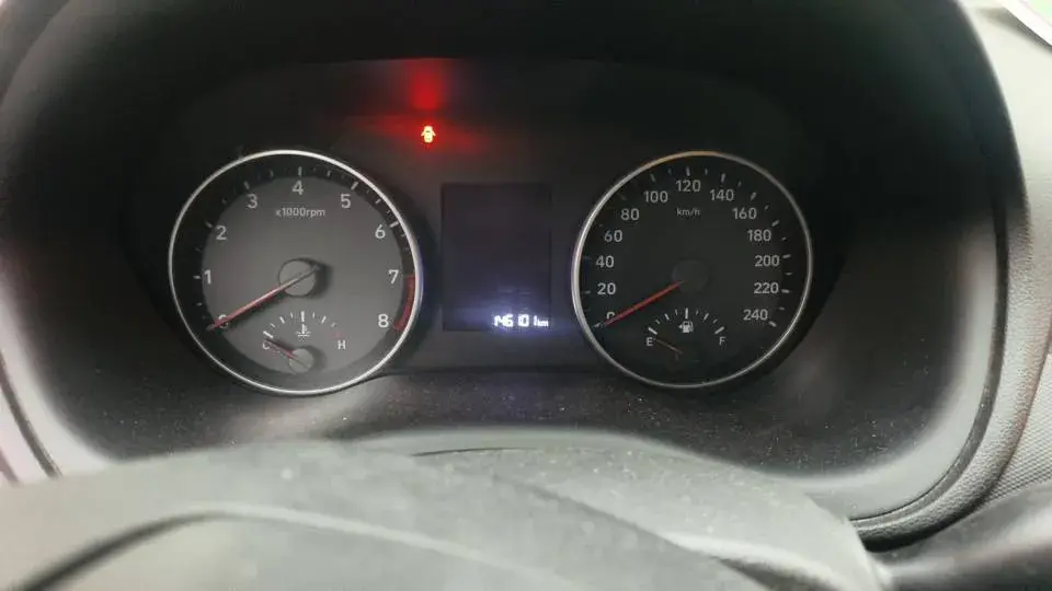 2017 HYUNDAI CELESTA thumbnail 4